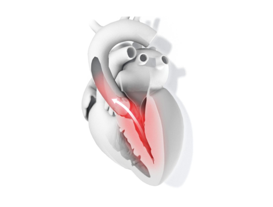 heart