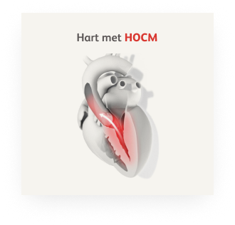 gezond hart